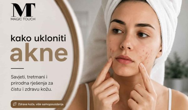 kako ukloniti akne